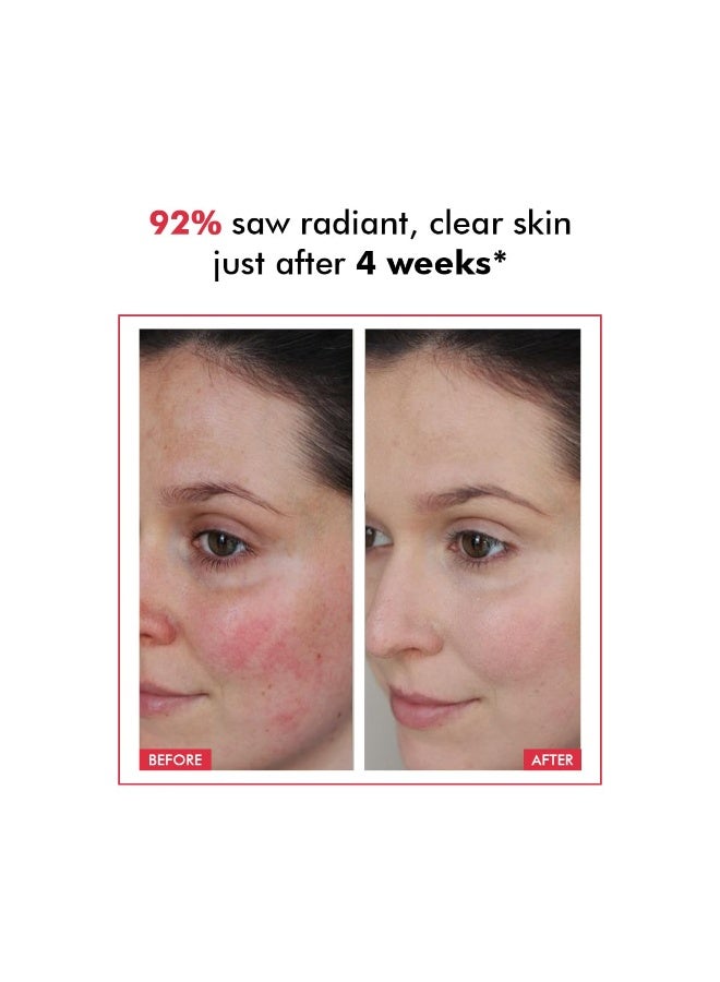 كيميائي واعي محلول التقشير من Conscious Chemist® بتركيز 25% AHA و2% BHA و5% PHA | 30 مل | محلول تقشير متطور لتجديد البشرة، سيروم مضاد للشيخوخة، سيروم مقشر للوجه للرجال والنساء - Derm Date - Image 4
